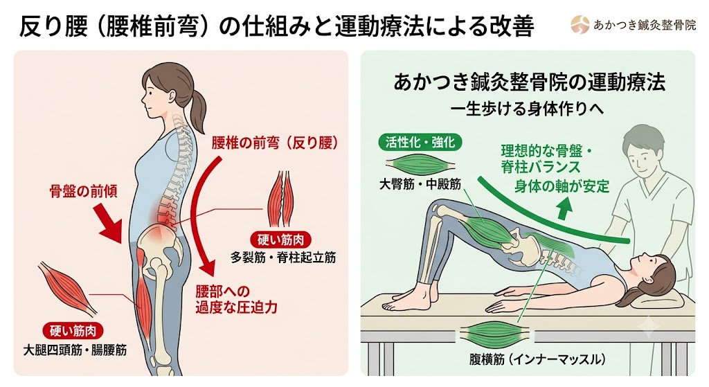 sorigoshi-undoryoho-koshigaya.jpg